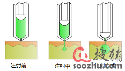 獸用無針注射器 現代化獸醫醫療器械的創新與優勢